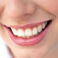 cosmetic dental insurance